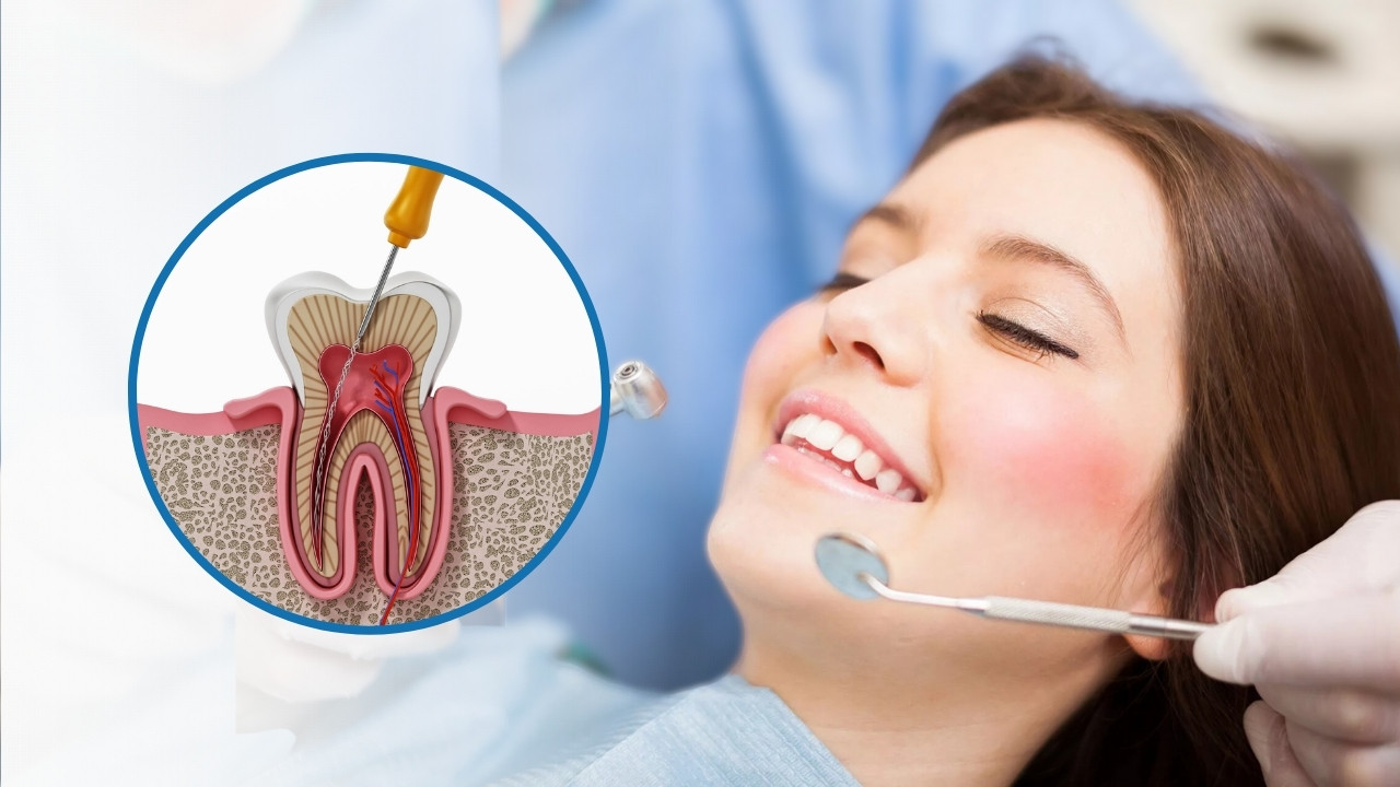Painless Root Canal Treatment in Mahatma Nagar Nashik