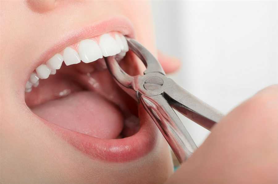 Painless Tooth Extractions in College Road Nashik | Dental Clinic